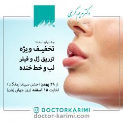 Dr. Maryam Karimi special offer : lip and smileline filler injection - face skin Rejuvenation by LDMmed and  mesoneedling