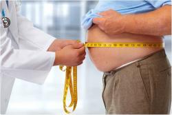 obesity and overweight